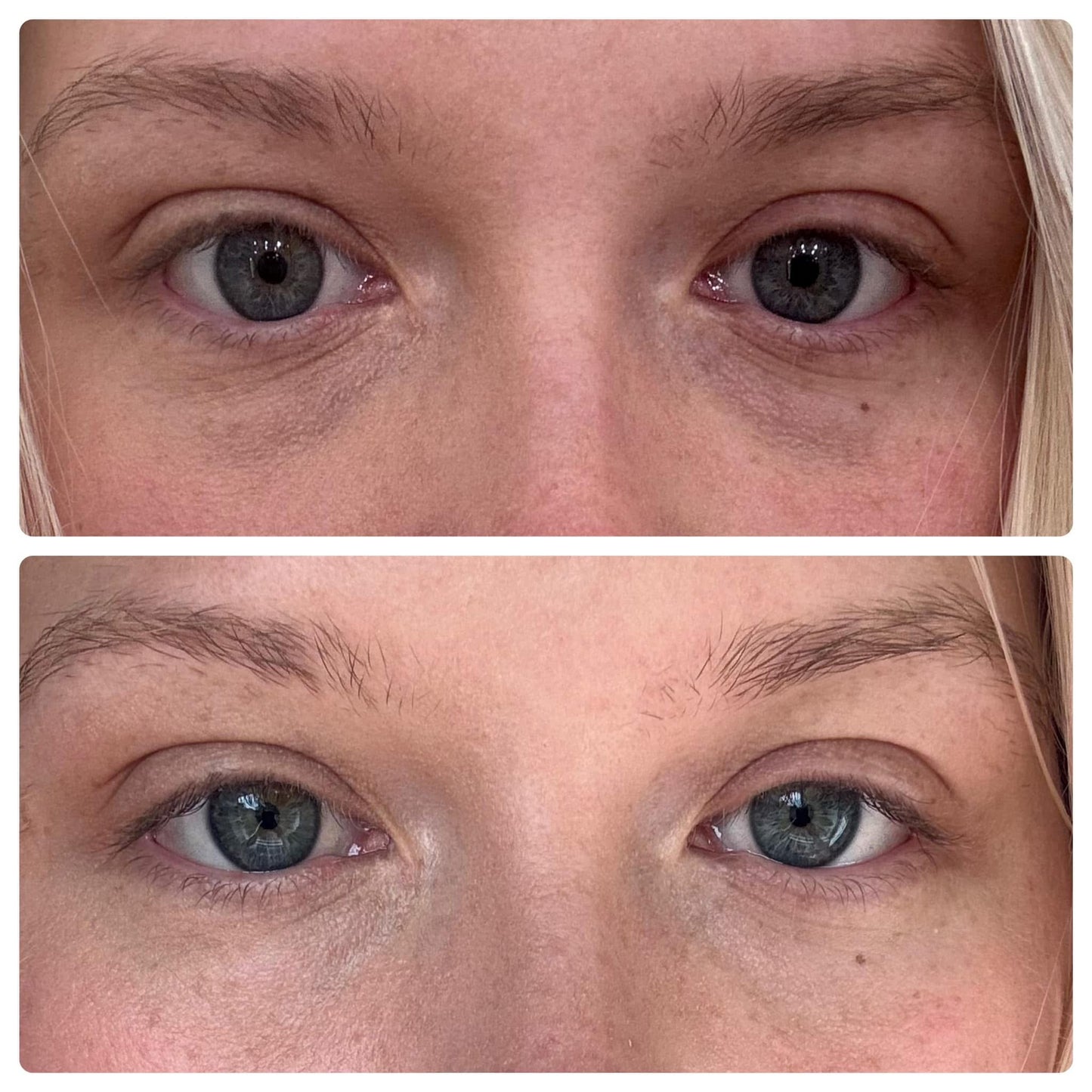 Caffeine Infused Tallow Eye Cream